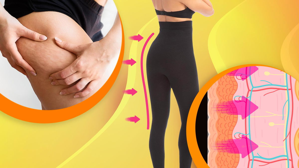 Modella che si tocca la cellulite e leggings anti cellulite