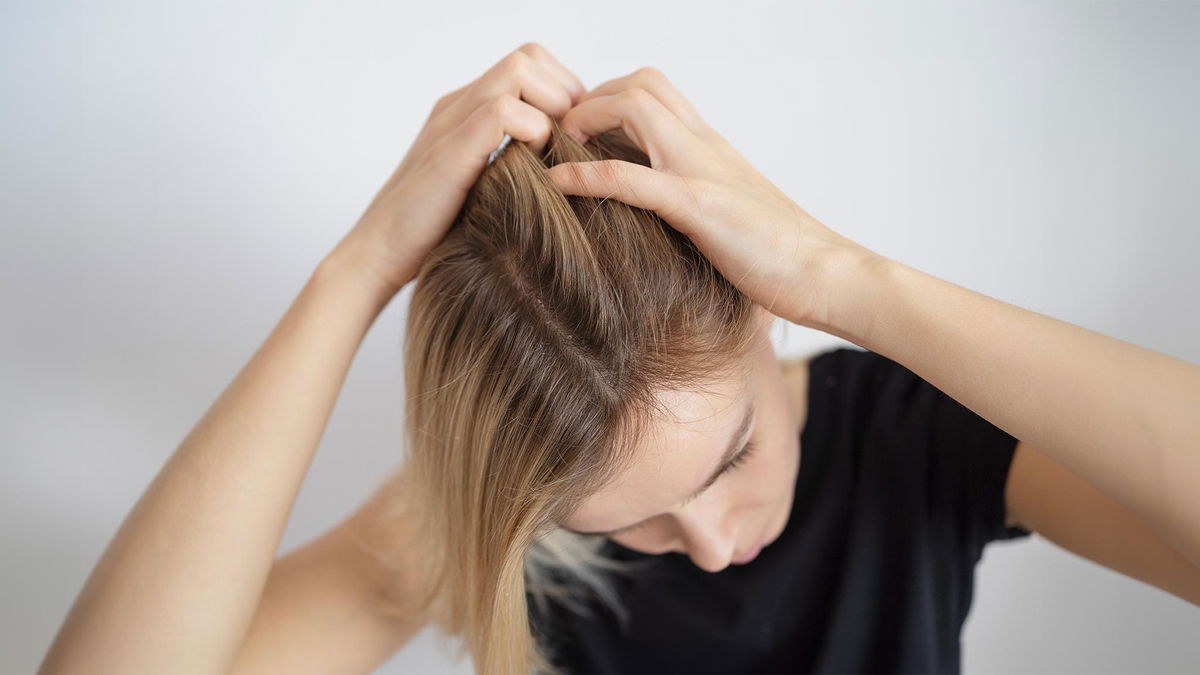 donna che si gratta cuoio capelluto irritato 