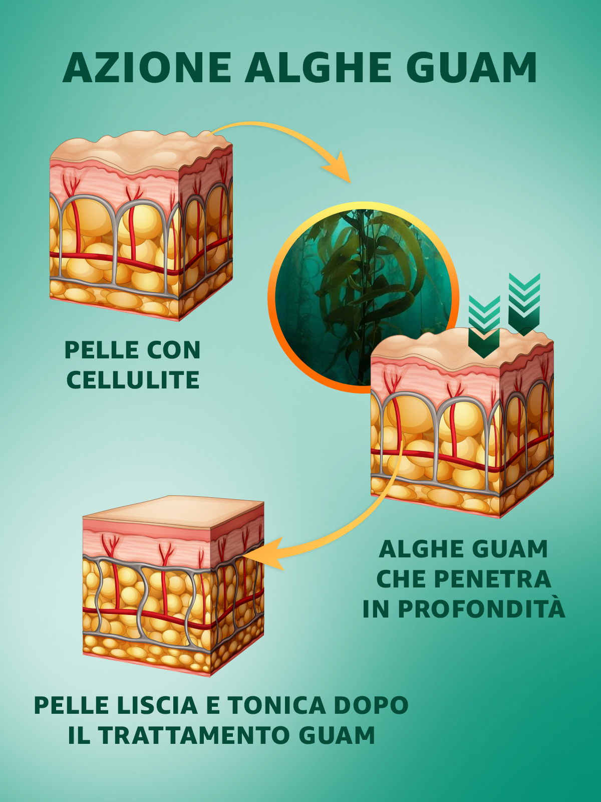 illustrazione azione fanghi alga guam su pelle con cellulite